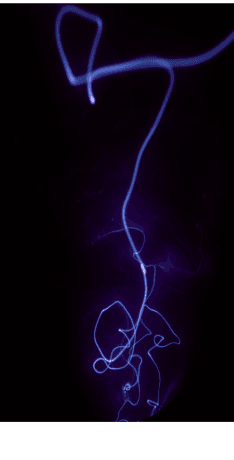 Lightening